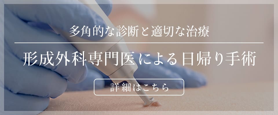 多角的な診断と適切な治療 形成外科専門医による日帰り手術